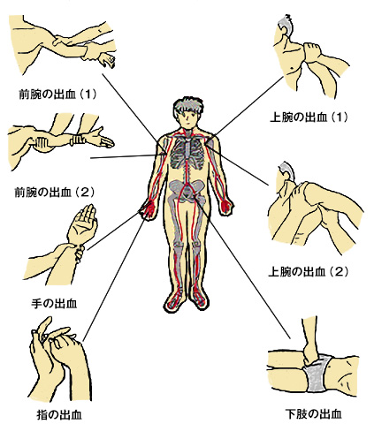 間接圧迫止血法（参考）